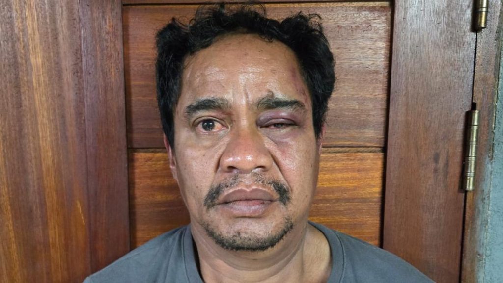 Polisi Tangkap Bandar Narkoba Jaringan Ko Erwin Si Boy Di Pontianak